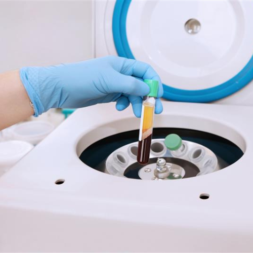 7 Questions about Platelet-Rich Plasma (PRP) Therapy